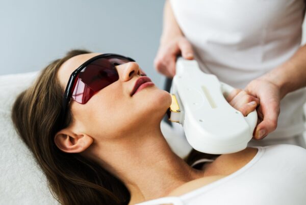 Laser Skin Treatment Potomac MD
